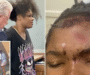 Stanley Assault: Teen Arrested After Elderly Men Hurt